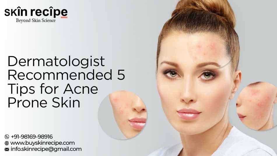 Acne Prone Skin
